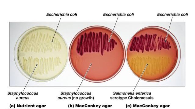 MacConkey agar selective and differentiation bacterial growth 